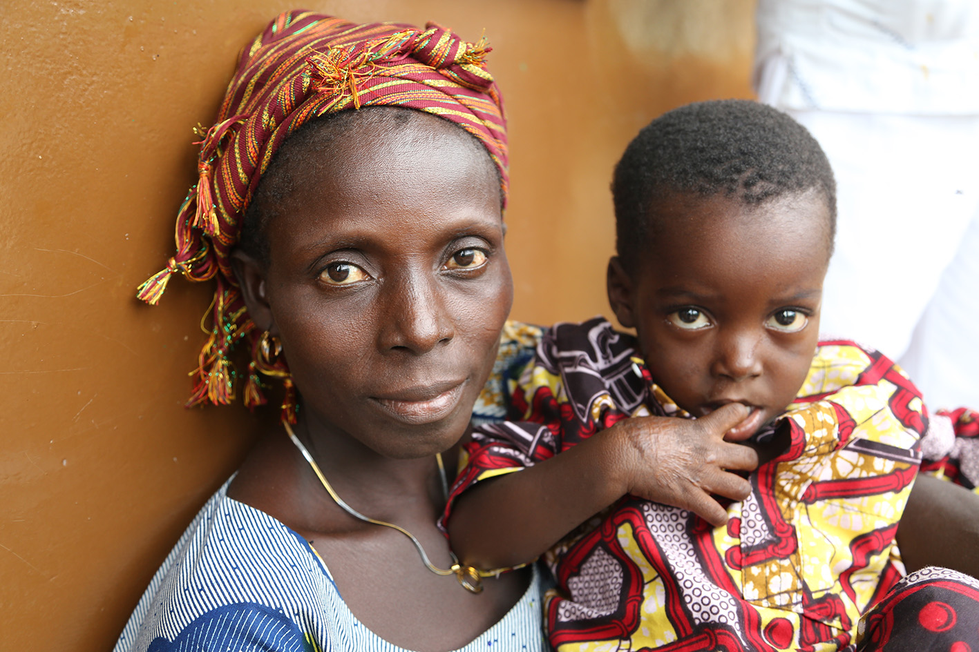 Fighting Buruli Ulcer In Benin. Fundacion Anesvad