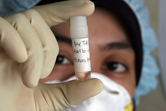 Avian Influenza testing